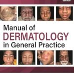 Manual of Dermatology in General Practice