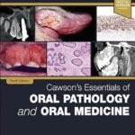 Cawson's Essentials of Oral Pathology & Oral Medicine (Color)