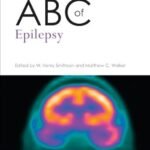 ABC of Epilepsy (Color)