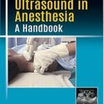 Applications of Ultrasound in Anesthesia A Handbook (Color)