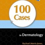 100 Cases in Dermatology (Color)