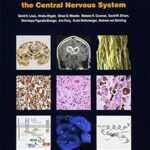WHO Classification of Tumours of the Central Nervous System (Color)