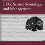 Atlas of EEG, Seizure Semiology, and Management (Color)