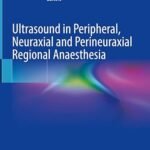 Ultrasound in Peripheral, Neuraxial and Perineuraxial Regional Anaesthesia (Color)