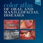 Color Atlas of Oral and Maxillofacial Diseases (Color)