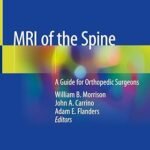 MRI of the Spine: A Guide for Orthopedic Surgeons (Color)