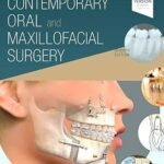 Contemporary Oral and Maxillofacial Surgery (Color)