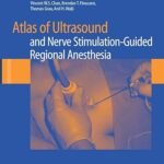 Atlas of Ultrasound- and Nerve Stimulation-Guided Regional Anesthesia (Color)