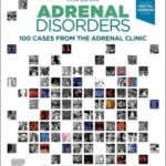 Adrenal Disorders: 100 Cases from the Adrenal Clinic (Color)
