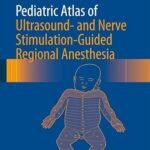 Pediatric Atlas of Ultrasound- and Nerve Stimulation-Guided Regional Anesthesia (Color)