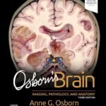 Osborn's Brain: Imaging, Pathology, and Anatomy Part 1-2 (Color)