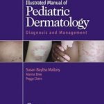 Illustrated Manual of Pediatric Dermatology: Diagnosis and Management (Color)