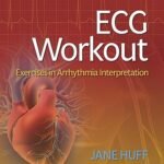 ECG Workout: Exercises in Arrhythmia Interpretation (Color)