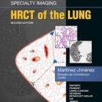 Specialty Imaging: HRCT of the Lung (Color)