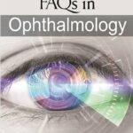 Aravind FAQs in Ophthalmology
