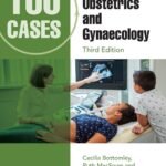 100 Cases in Obstetrics and Gynaecology (Color)