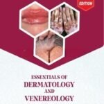 Essentials of Dermatology and Venereology