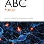 ABC of Stroke (Color)