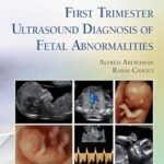 First Trimester Ultrasound Diagnosis of Fetal Abnormalities (Color)
