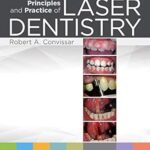 Principles and Practice of Laser Dentistry (Color)