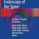 Unilateral Biportal Endoscopy of the Spine (Color)