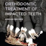 Orthodontic Treatment of Impacted Teeth (Color)