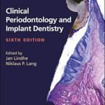 Clinical Periodontology and Implant Dentistry Volume 1-2 (Color)