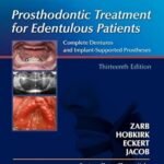 Prosthodontic Treatment for Edentulous Patients (Color)