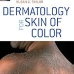 Dermatology for Skin of Color (Color)
