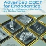 Advanced CBCT for Endodontics: Technical Considerations, Perception, and Decision-Making (Color)