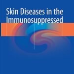 Skin Diseases in the Immunosuppressed (Color)