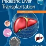 Pediatric Liver Transplantation: A Clinical Guide (Color)