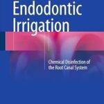 Endodontic Irrigation: Chemical disinfection of the root canal system (Color)