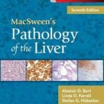 MacSween's Pathology of the Liver Volume 1-2 (Color)