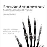 Forensic Anthropology: Current Methods and Practice (Color)