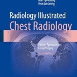 Radiology Illustrated: Chest Radiology: Pattern Approach for Lung Imaging (Color)