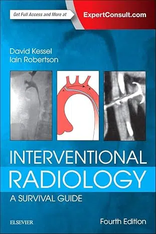 61DDkcIIunL._SY466_ (1)