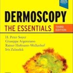 Dermoscopy: The Essentials (Color)