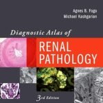 Diagnostic Atlas of Renal Pathology (Color)
