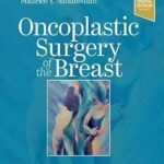 Oncoplastic Surgery of the Breast (Color)