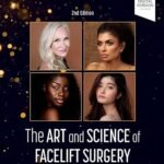 The Art and Science of Facelift Surgery (Color)