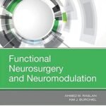 Functional Neurosurgery and Neuromodulation (Color)