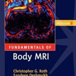 Fundamentals of Body MRI (Color)