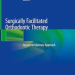 Surgically Facilitated Orthodontic Therapy: An Interdisciplinary Approach Volume 1-2 (Color)