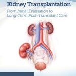 Quick Guide to Kidney Transplantation (Color)