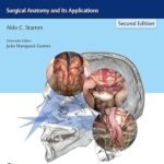Transnasal Endoscopic Skull Base and Brain Surgery (Color)
