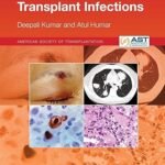 The AST Handbook of Transplant Infections (B&W)