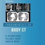Fundamentals of Body CT (Color)