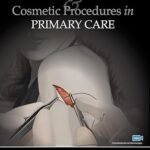 Dermatologic Surgery and Cosmetic Procedures in Primary Care Practice (Color)