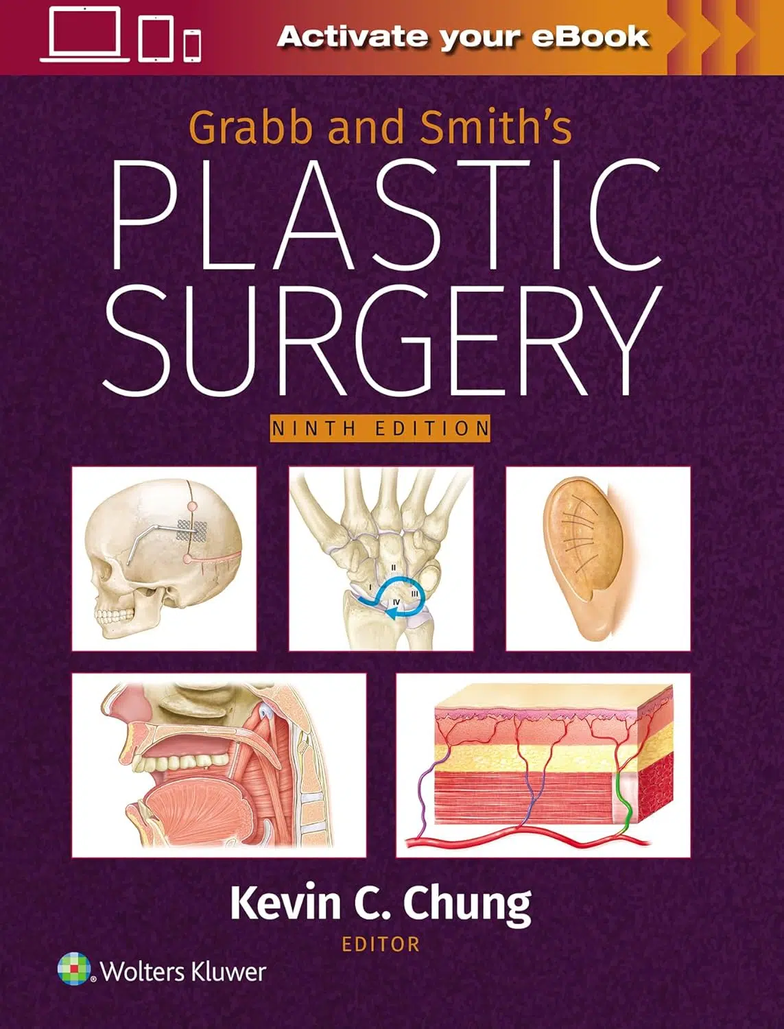 812p+hdqAfL._SL1500_ Grabb and Smith's Plastic Surgery Volume 1-2 (Color) - Image 1